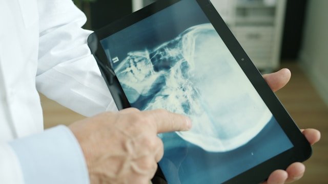 Injury Settlement